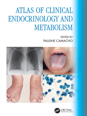 cover image of Atlas of Clinical Endocrinology and Metabolism